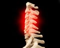 CT scan of C-Spine or Cervical spine 3D rendering Royalty Free Stock Photo