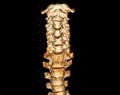 CT scan of C-Spine or Cervical spine Royalty Free Stock Photo