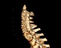 CT scan of C-Spine or Cervical spine Royalty Free Stock Photo