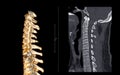 CT SCAN of Cervical Spine C-spine Royalty Free Stock Photo