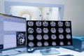 CT Scan control room and computer showing brain scan, Medical technology concept