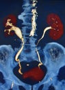 Ct scan 3d ct urography kidneys bladder colorful