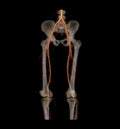 CT SCAN 2D and 3D rendering of lower extremity.