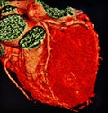 Ct scan 3d heart angiography colorful