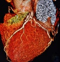 Ct scan 3d heart angiography colorful