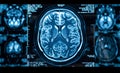 CT scan of the human brain Royalty Free Stock Photo