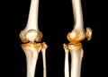CT Scan of  Knee joint 3D rendering Showing fracture of Patella Royalty Free Stock Photo