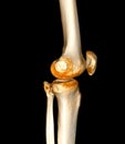 CT Scan of  Knee joint 3D rendering Showing fracture of Patella Royalty Free Stock Photo