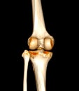 CT Scan of  Knee joint 3D rendering Showing fracture of Patella Royalty Free Stock Photo