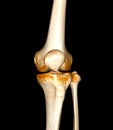 CT Scan of  Knee joint 3D rendering Showing fracture of Patella Royalty Free Stock Photo