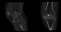 CT Scan of Knee joint for medical background