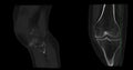 CT Scan of Knee joint for medical background