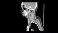 Ct scan of neck side view smooth motion