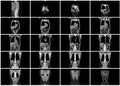 Ct scan step set of body coronal view