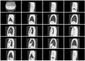 Ct scan step set of body lung sagittal view