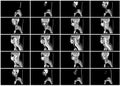 Ct scan step set of neck sagittal view