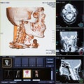 CT scans of human head