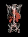 CTA abdominal aorta 3D rendering image