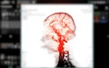 CTA Brain Vascular Imaging:.This image highlights a detailed 3D CTA scan of the brainÃ¢â¬â¢s vascular network, showing clear