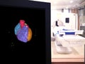 CTA Coronary artery 3D rendering image on the mornitor in CT Scanner room