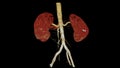 CTA Renal artery 3D is a medical imaging procedure using CT scans to examine the renal arteries It provides detailed images of the