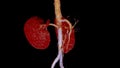 CTA Renal artery 3D is a medical imaging procedure using CT scans to examine the renal arteries It provides detailed images of the