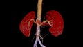 CTA Renal artery 3D is a medical imaging procedure using CT scans to examine the renal arteries It provides detailed images of the