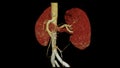 CTA Renal artery 3D is a medical imaging procedure using CT scans to examine the renal arteries It provides detailed images of the