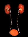 CTA Renal artery 3D rendering image showing both kidney, Ureter and bladder