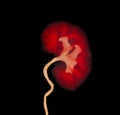 CTA Renal artery showing kidney 3D rendering image