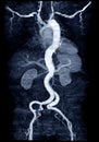 CTA whoe aorta with curve MPR technique