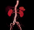 CTA whole aorta with Abdominal aorta stent graft compare 3D rendering image