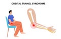 Cubital tunnel syndrome Royalty Free Stock Photo