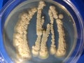 Candida albicans growing on sabouraud dextrose agar medium