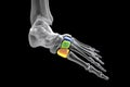 Cuneiform bones of the foot, 3D illustration