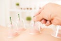 Cupping therapy spa woman removes