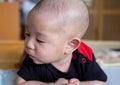 Curious Asian infant baby boy with lesion on his head lie on the stomach or prone, wearing black red clothes on the bed