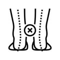 curvature of legs inward line icon vector illustration