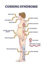 Cushing syndrome symptoms list from high cortisol level outline diagram