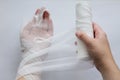 The cut arm rewound with a bandage. Medical theme. Royalty Free Stock Photo