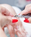 Cut cuticle on the female forefinger