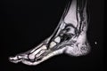 Cut through a human foot - MRT image Royalty Free Stock Photo