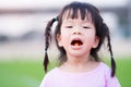 Cute Asian girl has dry and peeling lips. Children eat vitamin C orange color. Child opened his mouth wide. Kid braided two braids