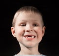 Cute boy missing some front teeth Royalty Free Stock Photo