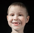 Cute boy missing some front teeth Royalty Free Stock Photo