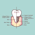 Cute cartoon tooth implant anatomy