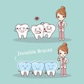 Cute cartoon tooth invisible braces Royalty Free Stock Photo