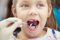 Cute child sits at dentist chair with smile Royalty Free Stock Photo