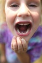 Cute Little Child Showing Off Wiggly Tooth