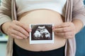 A cute pregnant belly and x-ray ultrasound scan of baby. Pregnant female motherhood concept. pregnant belly body part Royalty Free Stock Photo